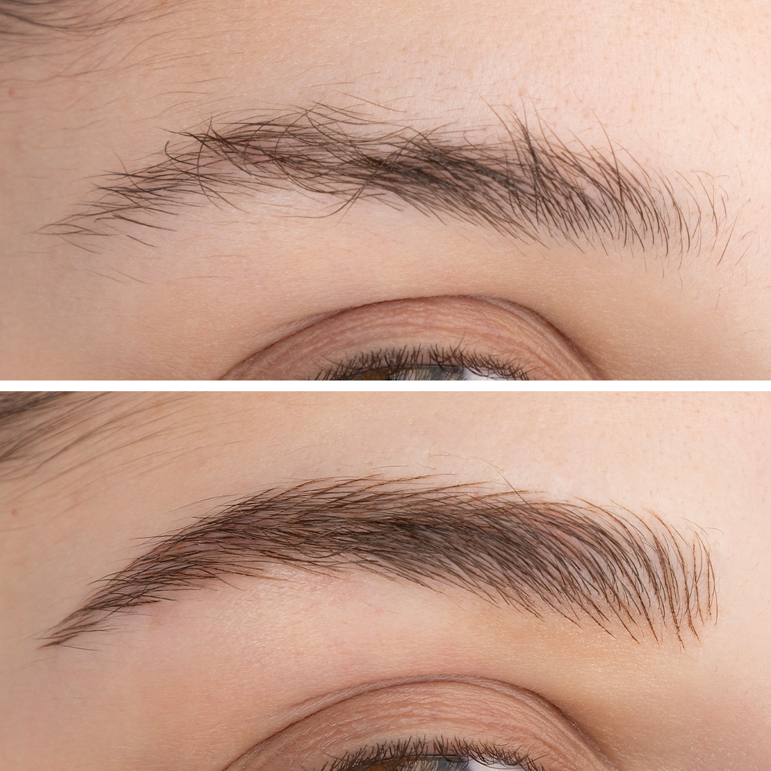 BB Stroke: Before & After BB Stroke: Before & After