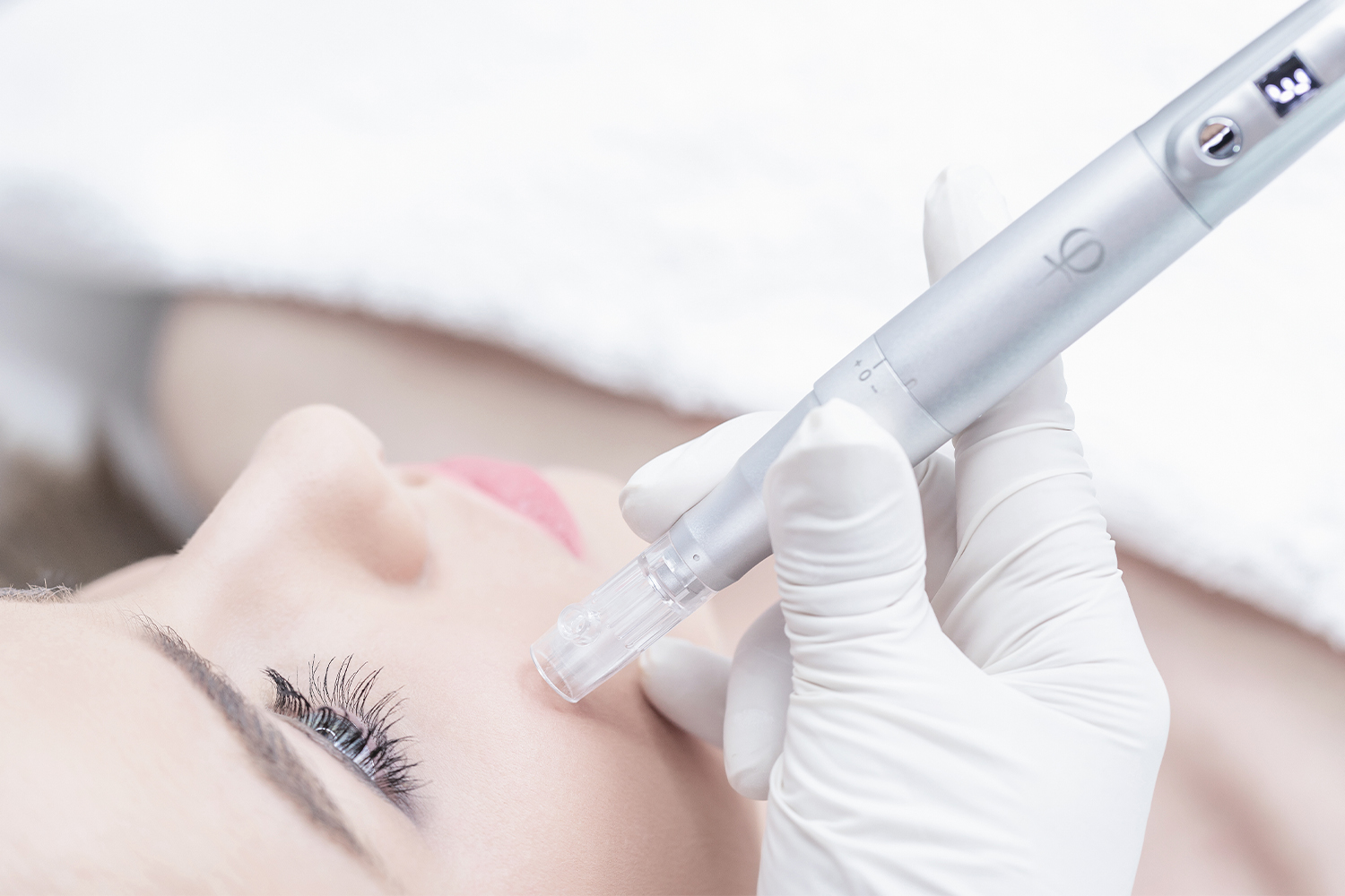 Procédure de microneedling avec un dermapen Procédure de microneedling avec un dermapen